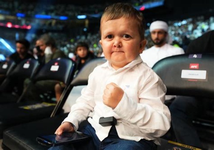 The Mystery Of Hasbulla's Rare Medical Condition