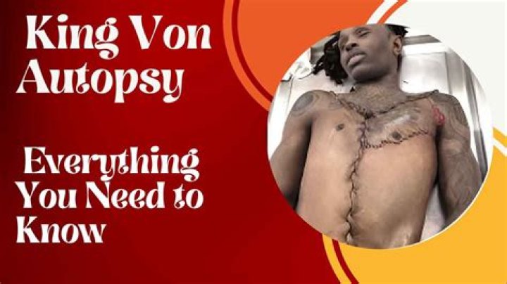 Unraveling The Mystery: The Dayvon Daquan Bennett Autopsy Report